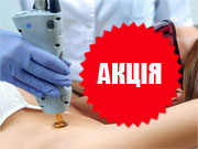Знижки на епіляцію